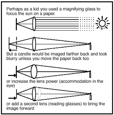 Presbyopia Eye Exercise Chart