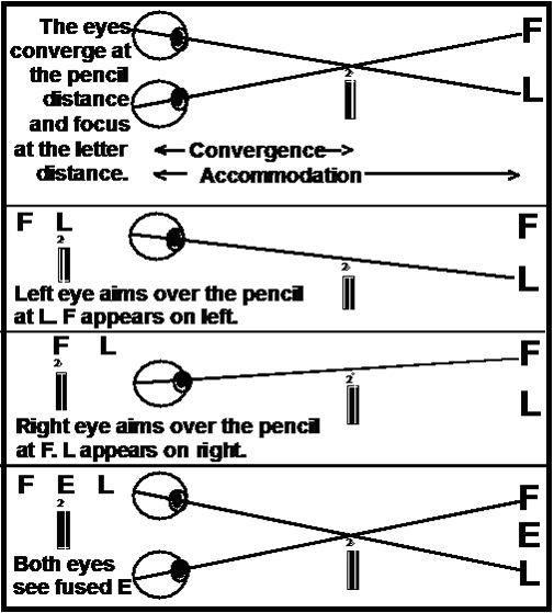 Presbyopia Eye Exercise Chart